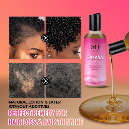 Sevich Batana Hair Growth Shampoo and Conditioner Set Anti Hair Loss for Men and Women Fast Regrowth by Beauty Bae