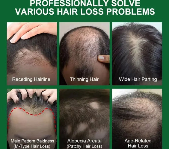 Ginger Scalp Growth Serum