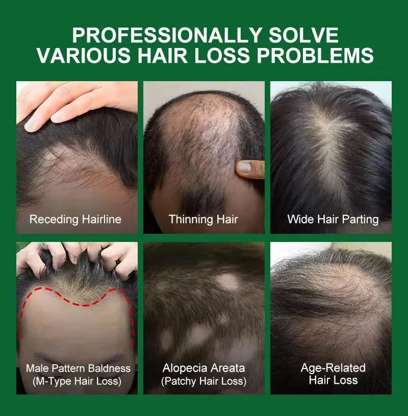 Ginger Scalp Growth Serum