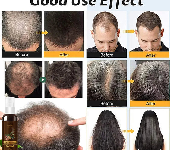 5 Days Ginger Scalp Cream