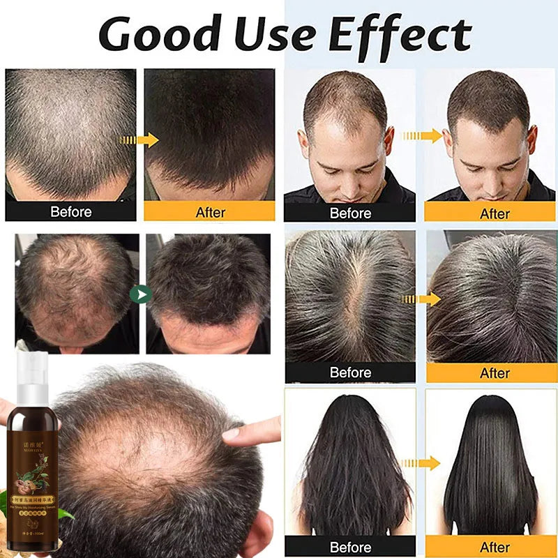 5 Days Ginger Scalp Cream