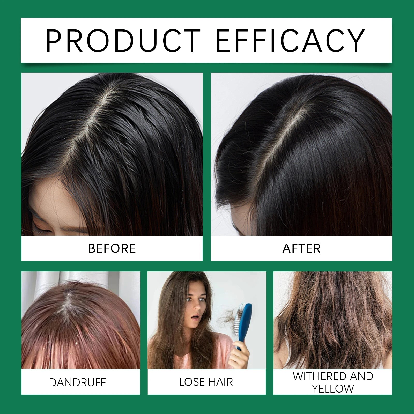 Tea Tree Shampoo and Conditioner Set for Dandruff Control and Scalp Care Oil Control Smoothing Shiny Hair 100ml by Beauty Bae