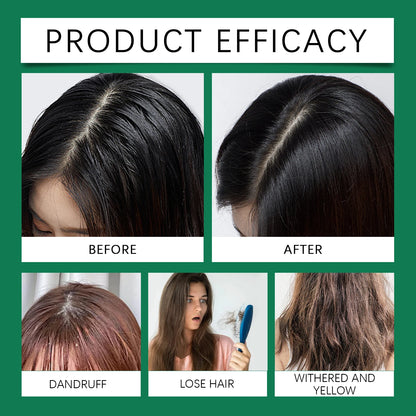 Tea Tree Shampoo and Conditioner Set for Dandruff Control and Scalp Care Oil Control Smoothing Shiny Hair 100ml by Beauty Bae