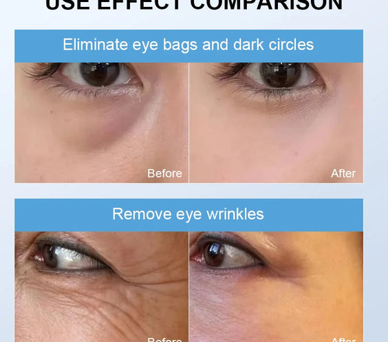 LED Red Light Eye Wand