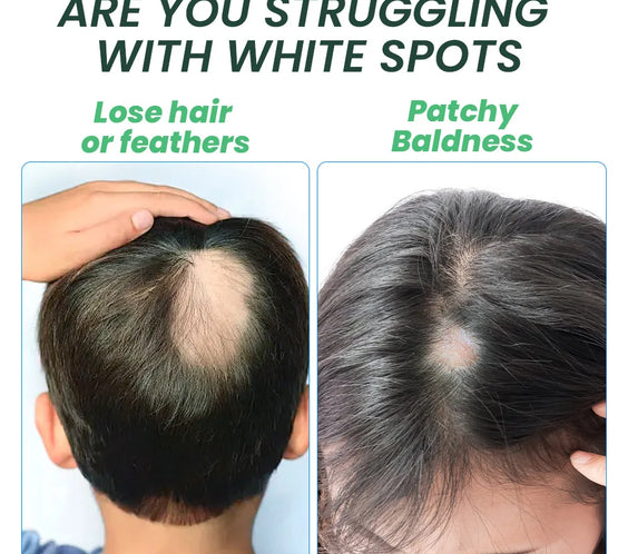 5 Days Ginger Scalp Cream