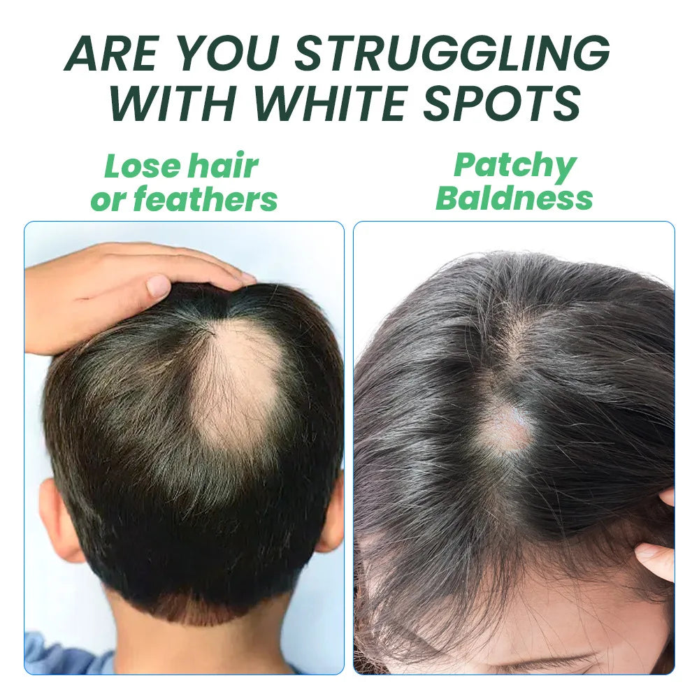 5 Days Ginger Scalp Cream