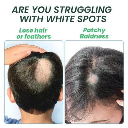 5 Days Ginger Scalp Cream - Beauty Bae