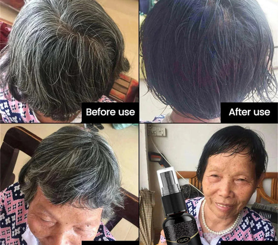 Gray To Black Hair Serum