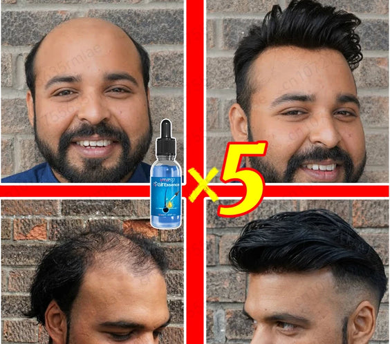 Scalp Serum Kit for Thinning