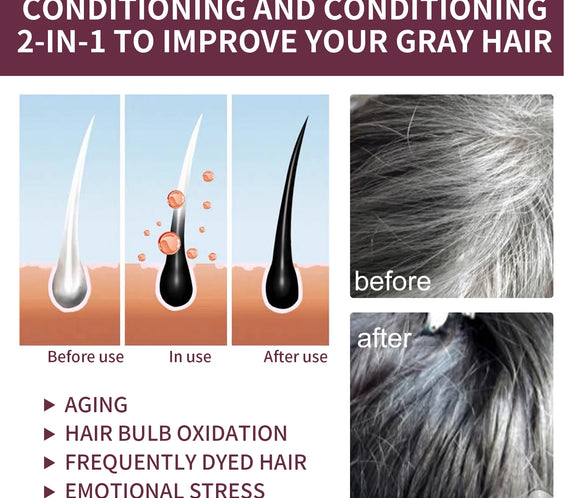 Polygonum Dandruff Shampoo 80g