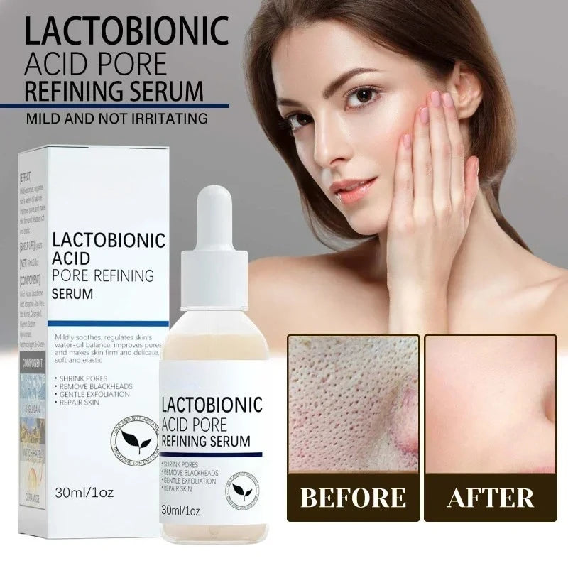 Lactobionic Pore Serum 30ml - Beauty Bae
