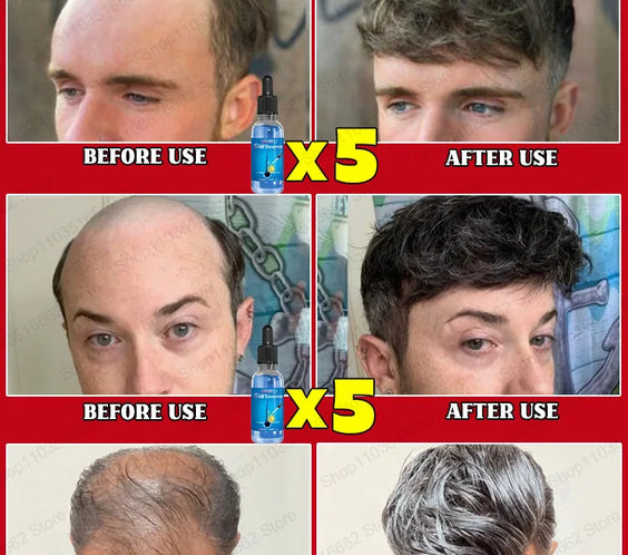 30ml Hair Growth Scalp Oil