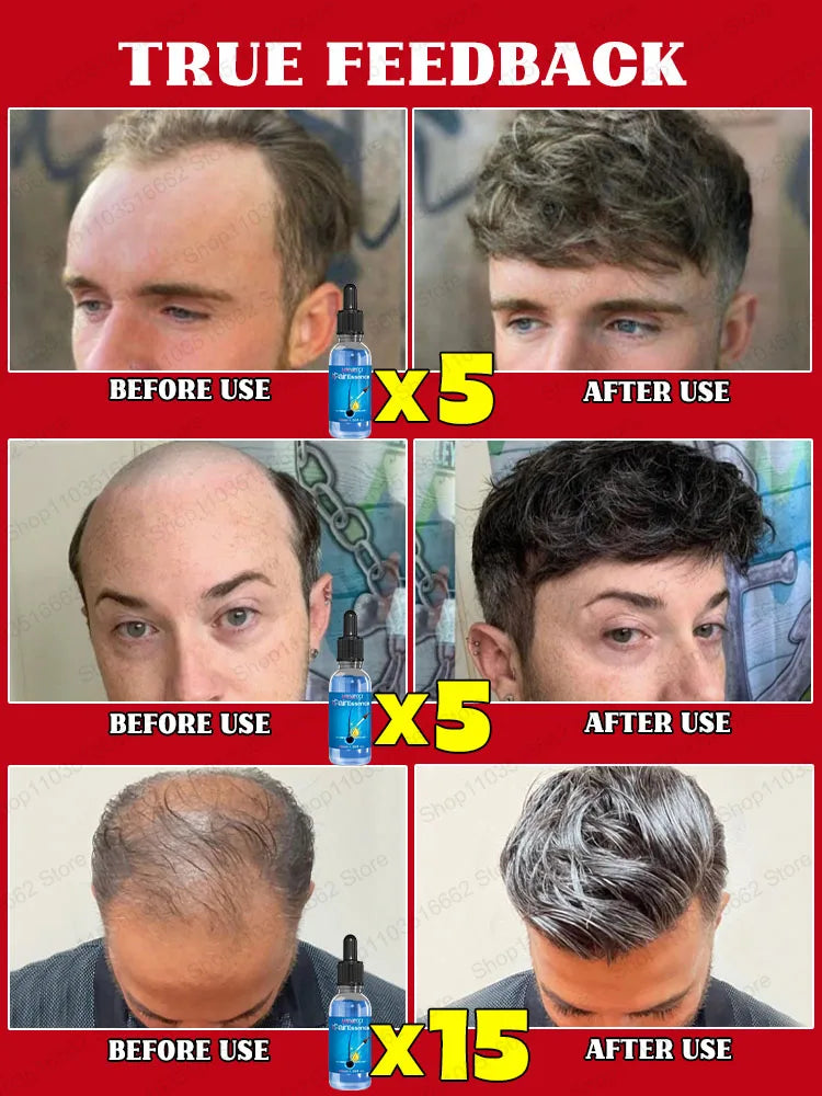 30ml Hair Growth Scalp Oil