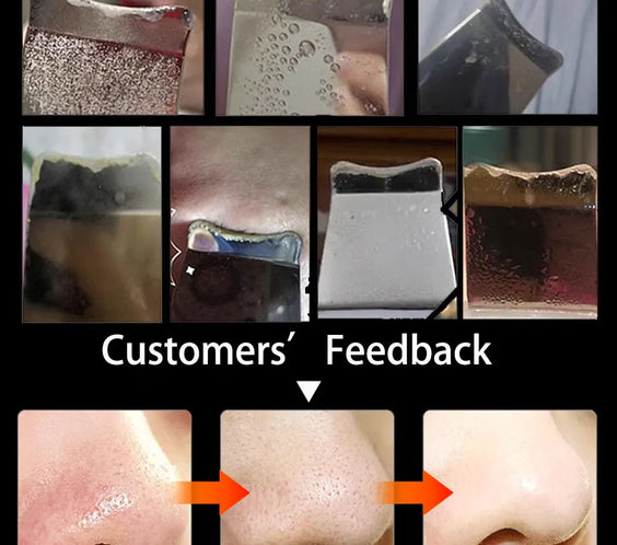 Ultrasonic Metal Skin Scraper