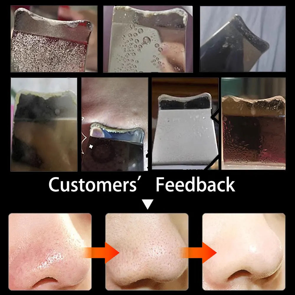 Ultrasonic Metal Skin Scraper