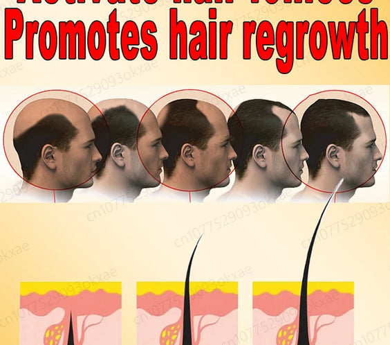 Scalp Serum Kit for Thinning