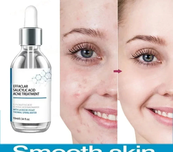 Salicylic Acid Pore Serum