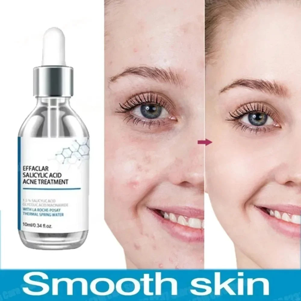 Salicylic Acid Pore Serum