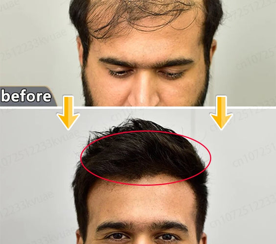 Hair Growth Kit 2025 Scalp with topical serum bottle and precision applicator labeled peptide vitamins fragrance-free option