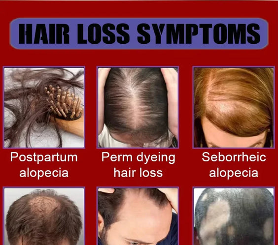 30ml Hair Growth Scalp Oil