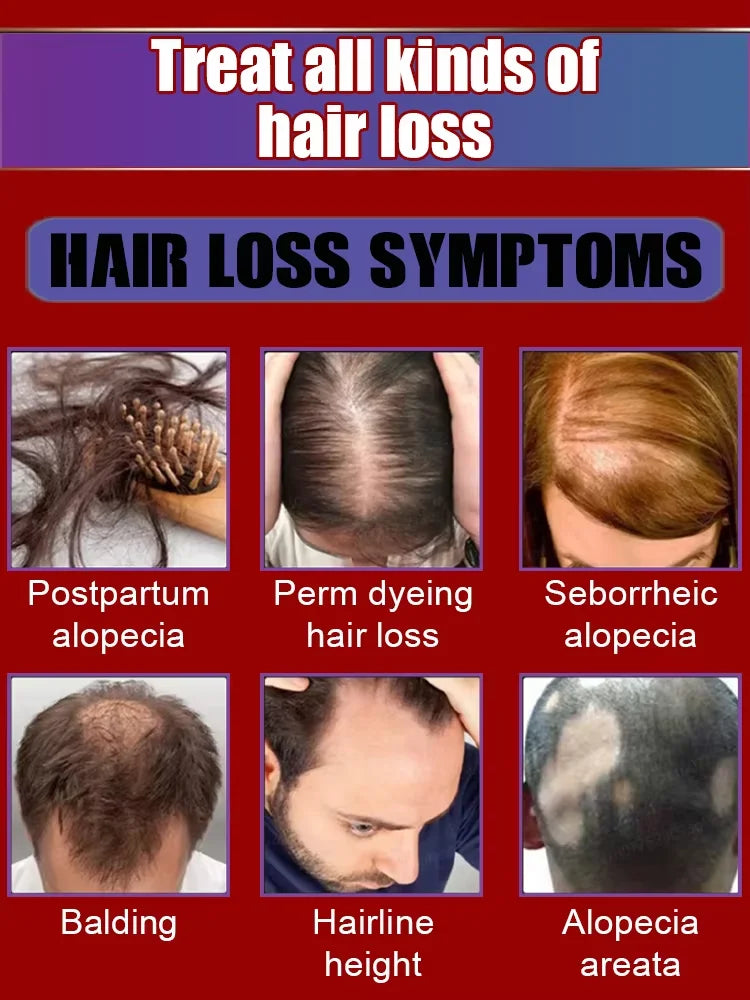 30ml Hair Growth Scalp Oil - Beauty Bae