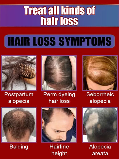 30ml Hair Growth Scalp Oil - Beauty Bae