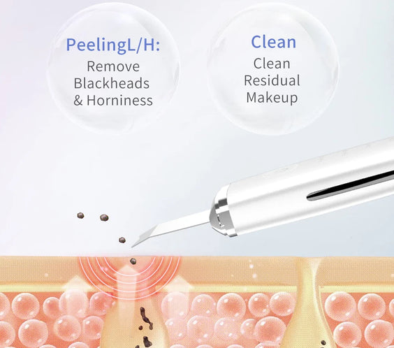 Ultrasonic Metal Skin Scraper