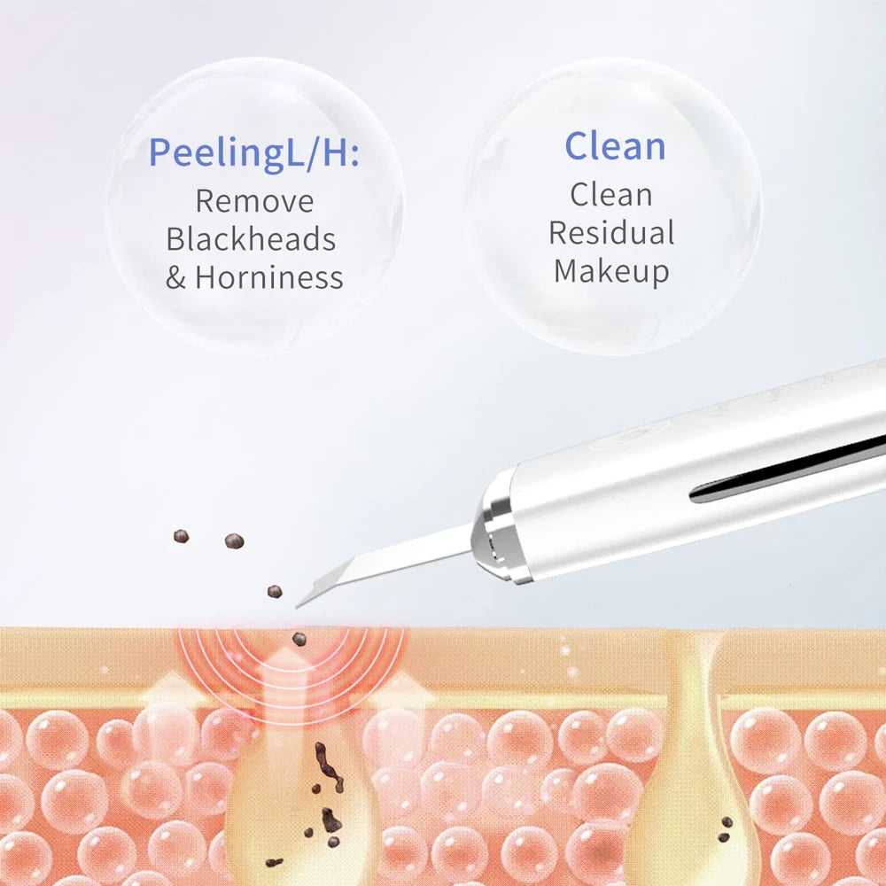 Ultrasonic Metal Skin Scraper - Beauty Bae