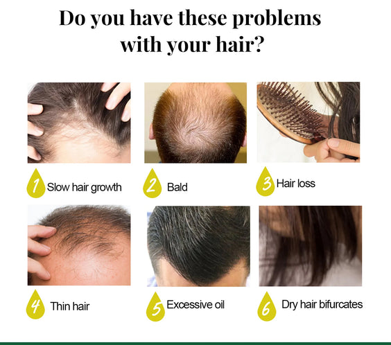 Ginger Scalp Growth Spray