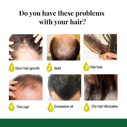 Ginger Scalp Growth Spray - Beauty Bae