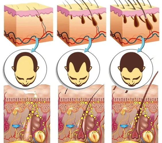 Ginger Hair Growth Serum 30ml