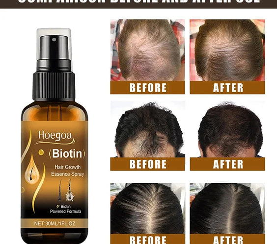 Biotin Hair Growth Spray 30ml