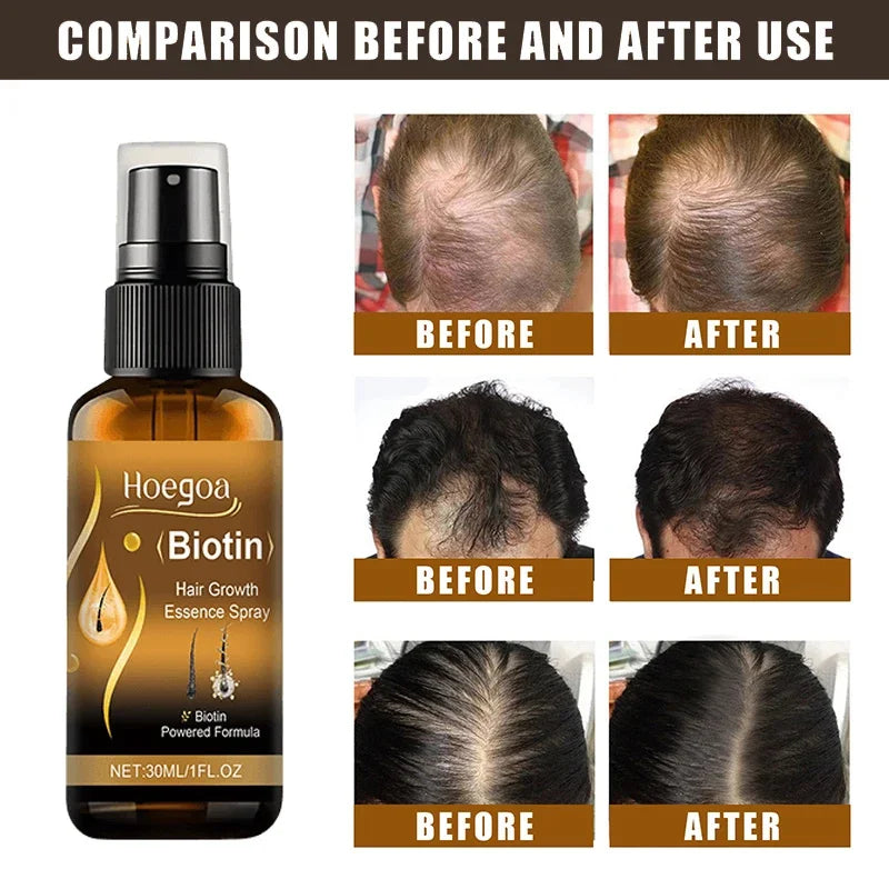 Biotin Hair Growth Spray 30ml