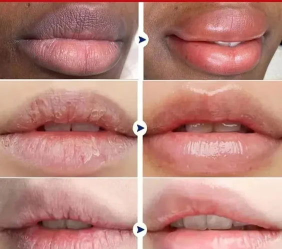 Lip Brightening Serum