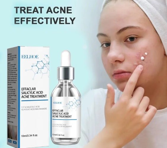 Salicylic Acid Pore Serum dropper bottle labeled eelhoe lightweight liquid for targeted acne and blackhead treatment