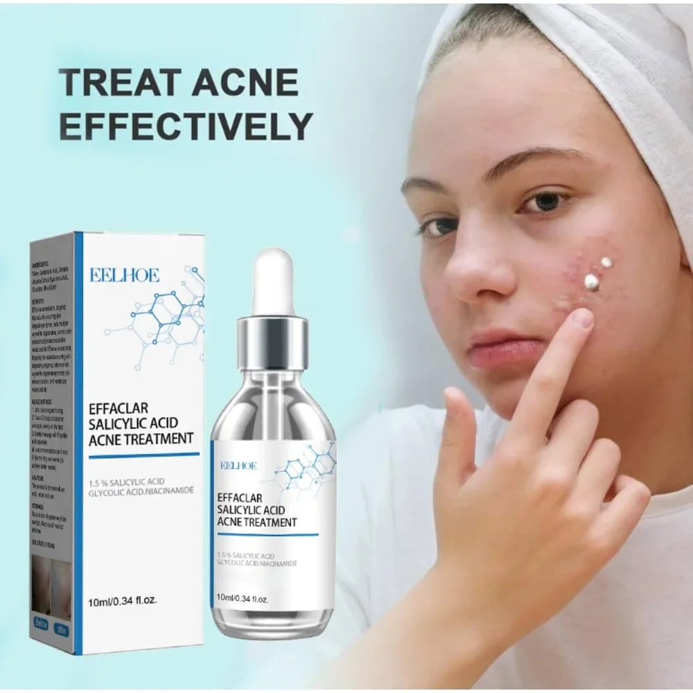 Salicylic Acid Pore Serum dropper bottle labeled eelhoe lightweight liquid for targeted acne and blackhead treatment