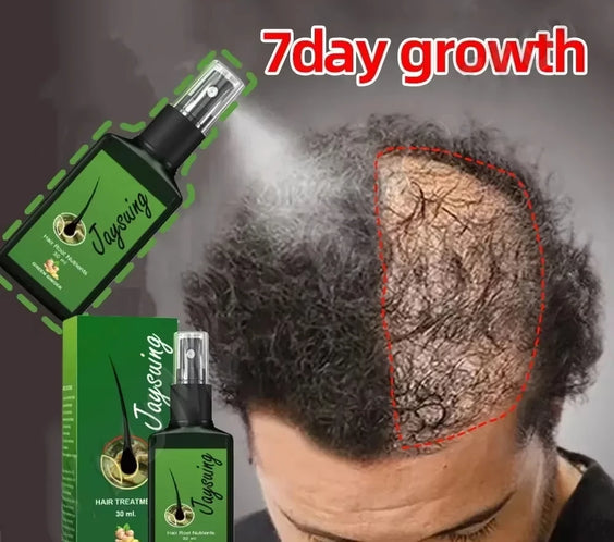 Ginger Hair Growth Serum 30ml spray bottle labeled Model PRO09 Production License 202409077