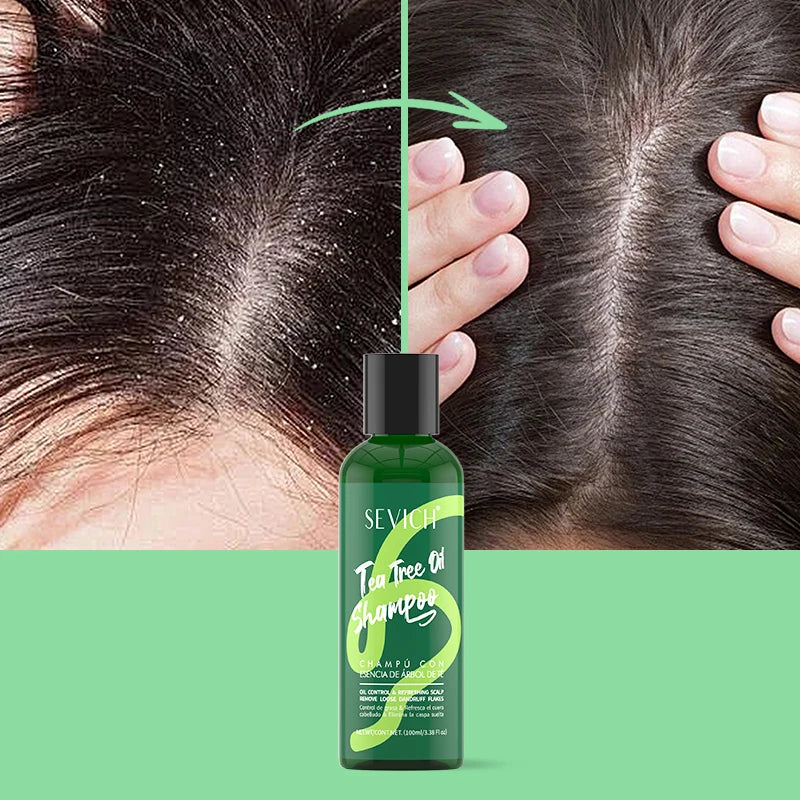 Tea Tree Essence Shampoo And Conditioner Set For Deep Cleansing Moisturizing Scalp Care Strengthening by Beauty Bae