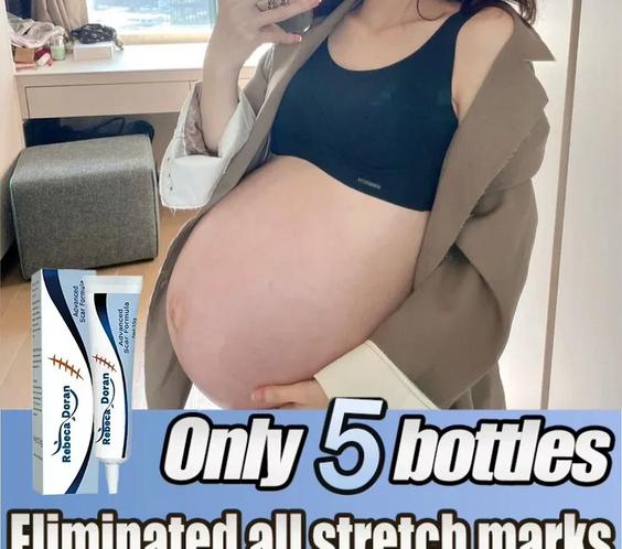 Stretch Mark Repair Cream tube labeled unisex moisturizing firming formula under 100g made in China