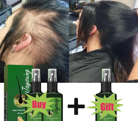 Ginger Scalp Growth Serum