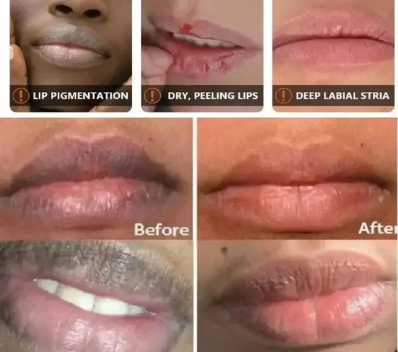 Lip Brightening Serum