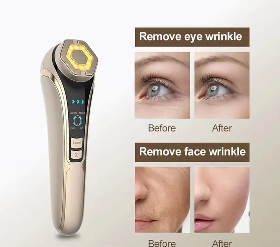 RF EMS Photon Facial Tightener