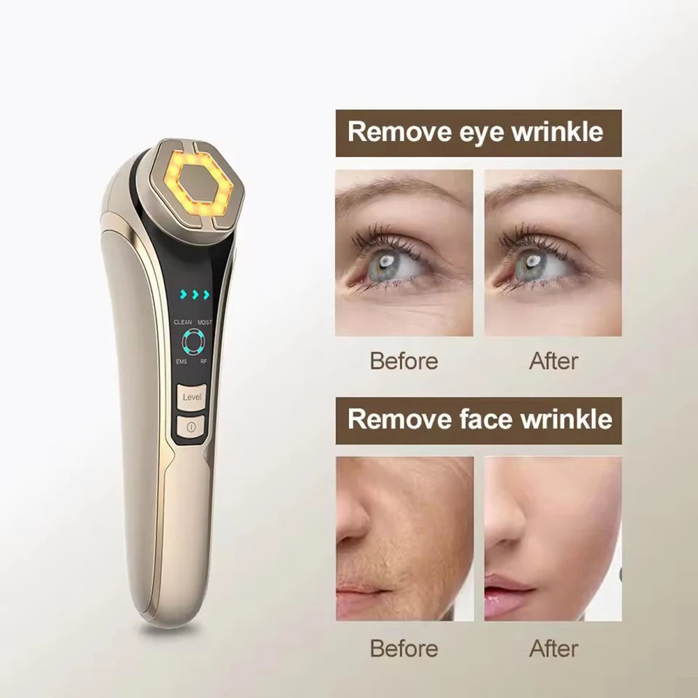 RF EMS Photon Facial Tightener