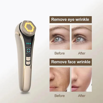 RF EMS Photon Facial Tightener - Beauty Bae