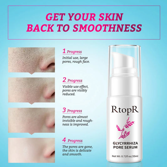 Pore Shrink Essence Serum