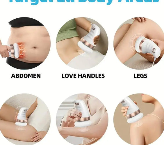 MARFLY K01 Cellulite Massager