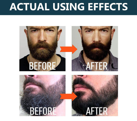 Ginger Beard Growth Serum