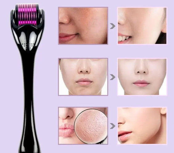 540 Titanium Derma Roller