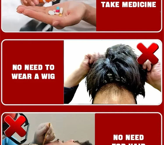 30ml Hair Growth Scalp Oil