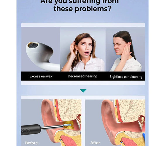 Bebird R3 Visual Ear Camera